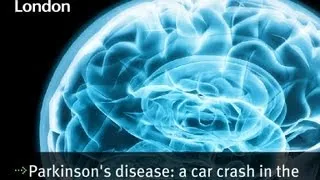 Parkinson's disease: a car crash in the brain