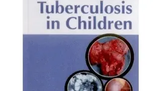 Pediatric Tuberculosis / NTEP