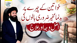 Khawateen Ke Chehre Par Badnuma,Gair Zarori Balon Ka Ilaj | Face Hair Removal For Women