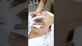 Dịch vụ Lấy Nhân Mụn Chuyên Sâu tại MiA Beauty Spa ♥️😍