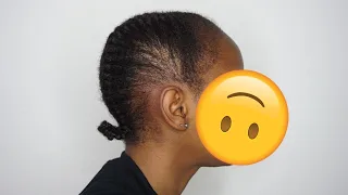 Having Fine, Thin and THINNING Natural Hair