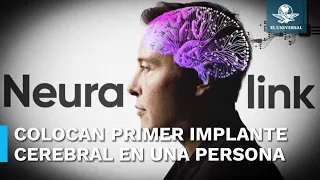 Elon Musk anuncia que Neuralink realizó el primer implante de chip cerebral en una persona