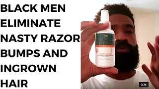 5 Ways Black Men ELIMINATE NASTY Ingrown Hairs and Razor Bumps