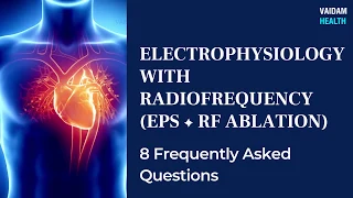EPS RF Ablation- 8 Frequently Asked Questions