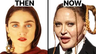 Madonna Plastic Surgeries - Surgeon Reacts