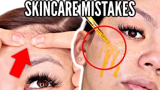 10 SKINCARE MISTAKES YOU'RE MAKING THAT CAUSE ACNE AND CLOGGED PORES! Skincare Tips For Clear Skin