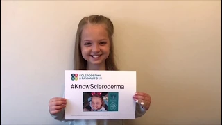 What are the first symptoms of scleroderma?