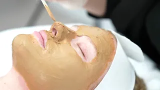 Cosmelan Depigmentation Procedure