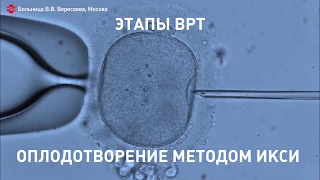 Отделение ЭКО городской клинической больницы им. В.В. Вересаева