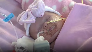 Baby born with heart outside body 'doing well'