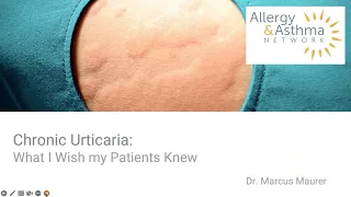 Chronic Urticaria   What I Wish My Patients Knew