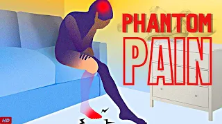 PHANTOM PAIN AND TREATMENT