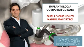 Implantologia Computer Guidata: quello che non ti hanno mai detto!