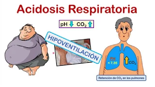 INTERPRETACIÓN DE LA GASOMETRÍA EN 4 PASOS 💉💉 (con EJERCICIOS de PRÁCTICA al final del video)