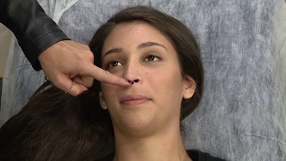 Rinomodelação: Técnica que remodela o nariz sem cirurgia plástica!
