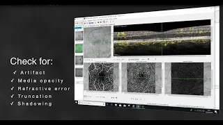 Systematic Interpretation of OCT Angiography Images