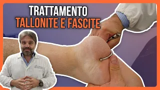 TALLONITE E FASCITE: un ESEMPIO di TRATTAMENTO MANUALE EFFICACE!