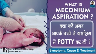 Meconium Aspiration Syndrome || Symptoms, Cause and Treatment