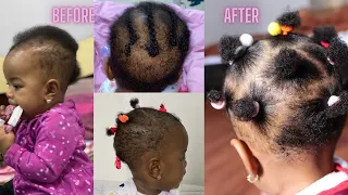 How I Grew My Baby’s Bald Spot And Hair Fast | Easy To Use And 100% Effective