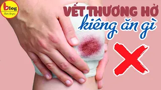 Top 8 thực phẩm nên kiêng ăn khi có vết thương hở