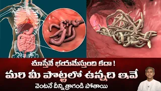 Bacteria in Stomach | Improves Digestion | Hypochlorhydria | Dr.Manthena's Health Tips