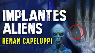 IMPLANTES E SERES MULTIDIMENSIONAIS - Renan Capeluppi -  Paranormal Experience! - #53