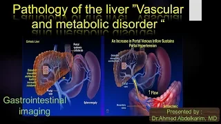 3-Liver pathology (vascular and metabolic disorders)