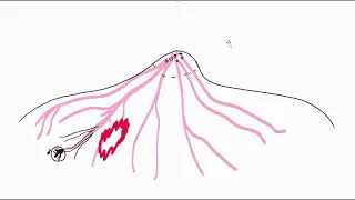 Principle of DTI(Diffusion tensor imaging) in breast cancer imaging