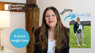 Maries's story with a gastric sleeve - 8 stone weight loss