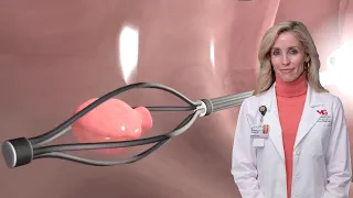 The Importance of a Screening Colonoscopy | Elizabeth Lindsey, M.D.