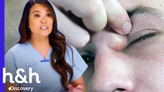 ¡Estos bultos no se pueden esconder! | Dra. Sandra Lee: Especialista en Piel | Discovery H&H