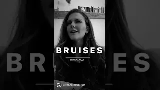 Bruises - Lewis Capaldi (Cover)