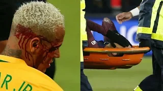 Neymar Top 5 Worst injuries of his career