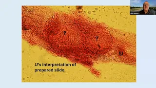 John Janovy Jr. Life Lessons from a Parasite: The Nematobothrium texomensis story.