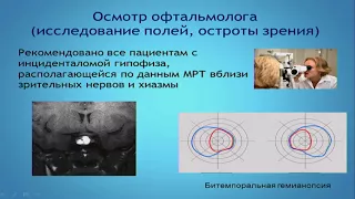 Астафьева Л.И. Диагностика и тактика ведения пациента с микроаденомой гипофиза