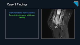 2022 QA Forum Part 3 | 15 Minute Radiology CME