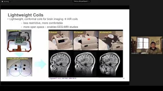 S3.GB.P02 T.Foo MRI Hardware