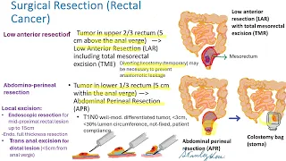 colorectal cancer 2024 New treatment, New Hope