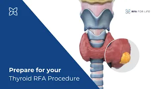 Prepare for your Thyroid RFA Procedure