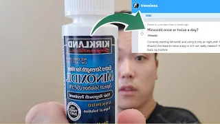 THIS IS HOW MANY TIMES A DAY YOU SHOULD BE APPLYING MINOXIDIL FOR HAIR LOSS! *SOLVED*