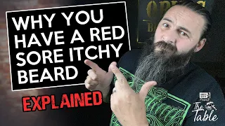 Why your skin is red, itchy and sore under your beard