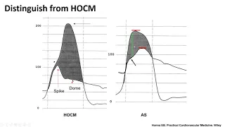 Hemodynamic assessment of aortic stenosis: technical tips- Elias Hanna, Univ of Iowa