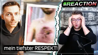 REAKTION: "Wenn dein Köper langsam abstirbt..." (von Life Lion) | #iToJuReaction