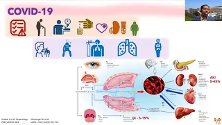 COVID19 and kidney disease