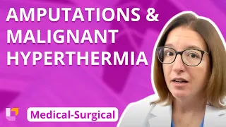 Amputations & Malignant Hyperthermia - Medical-Surgical - Musculoskeletal System | @LevelUpRN