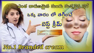 Melamet cream uses in telugu | best cream for melasma | skinshine cream |  మంగు మచ్చలు