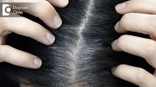 Causes & Remedies for Premature Greying of Hair - Dr. Rasya Dixit