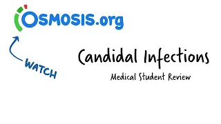 Candidal Infections: Osmosis Study Video