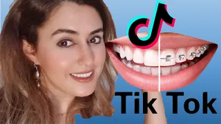 Orthodontist Reacts to Braces Off Tik Tok's!