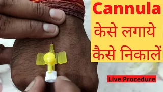 Cannula Kaise Lagate Hain | Kaise Nikale | Cannula Insertion Technique | Cannula Types | Hindi